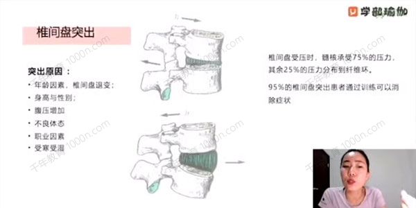 马子惟 腰间盘突出康复教培